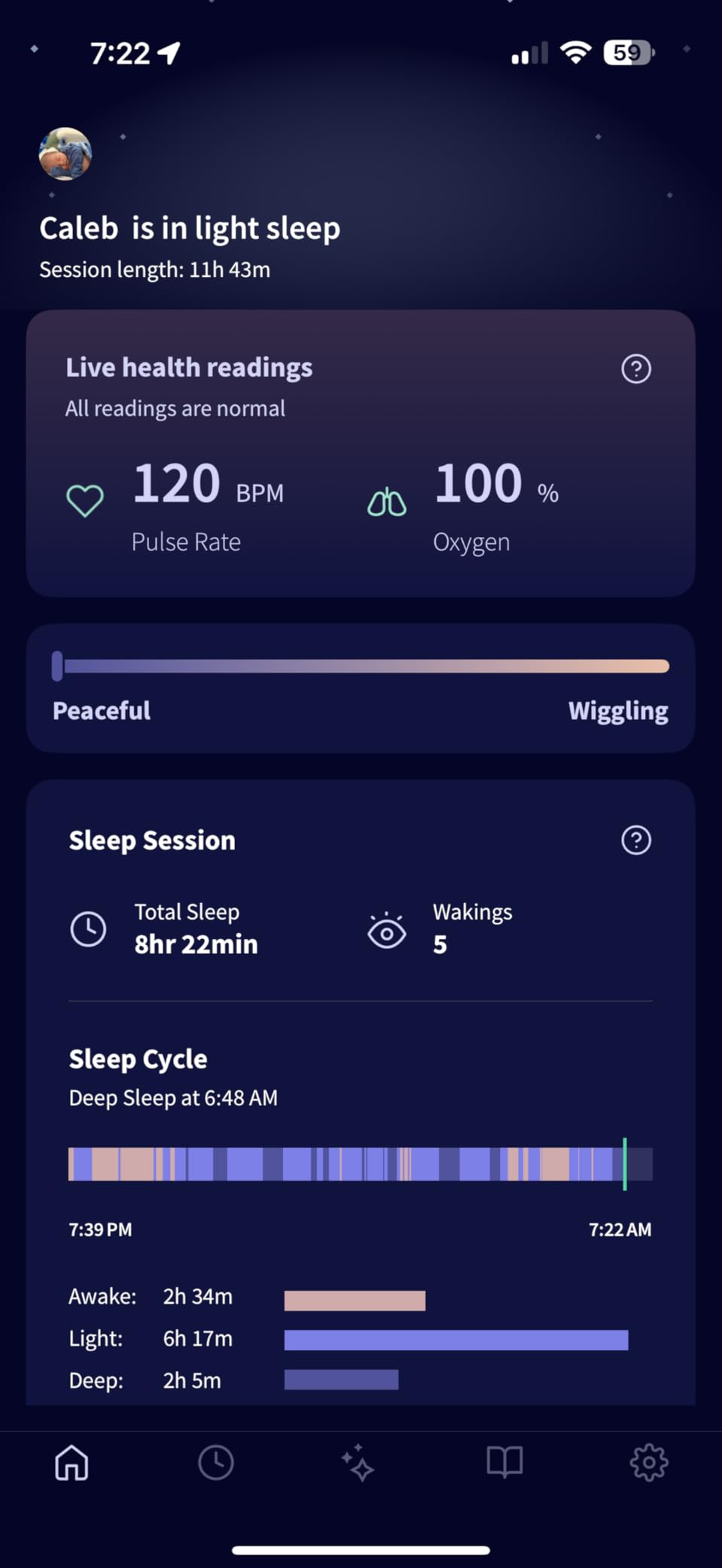 Owlet Dream Sock Smart Baby Monitor, Better Sleep for Baby & You customer photo 1